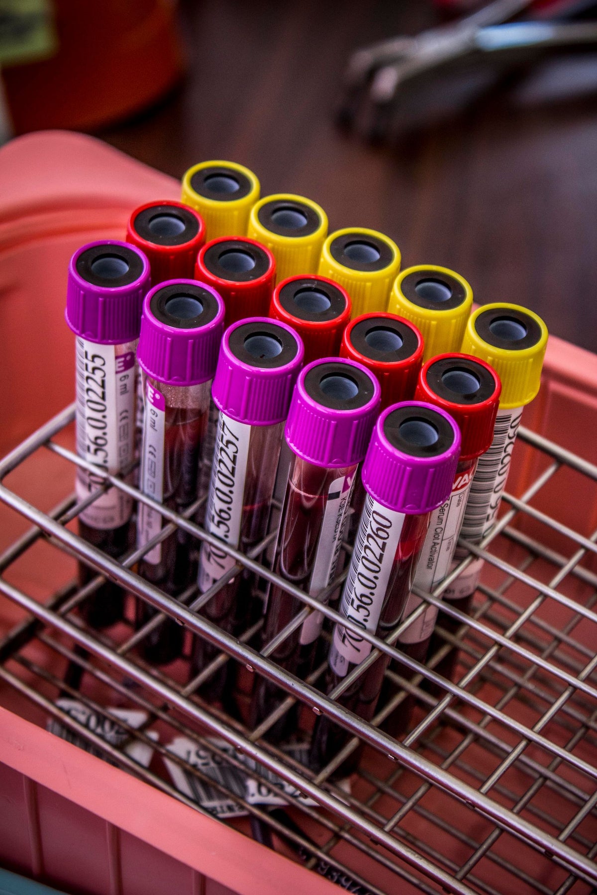 Blood test tubes in a rack