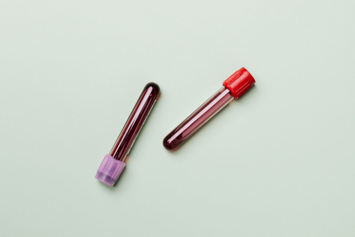 Blood sample test tubes